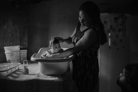 <p>2. Preis Zeitgeschehen/Stories: Die 30-jährige Brasilianerin Adriana Cordeiro Soares badet ihren drei Monate alten Sohn, der mit Mikroenzephalie geboren wurde - einer vermutlich durch das Zika-Virus bedingten Missbildung des Gehirns.&nbsp;</p>
