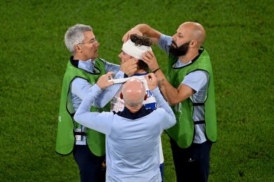 Im EM-Spiel zwischen Frankreich und Österreich ging es ordentlich zur Sache. Kylian Mbappé holte sich eine blutige Nase, Antoine Griezmann (M) eine Platzwunde am Kopf - und trotzdem haben die Franzosen einen 1:0-Sieg gegen die Österreicher geschafft.