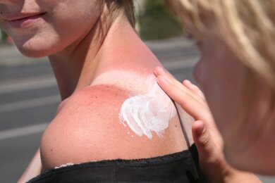 Zu viel Sonne auf die Schultern bekommen? Dann helfen Kühlung und eine beruhigende Hautpflege.