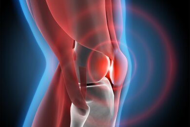 Schmerzen im Knie machen jede Bewegung zur Qual.
