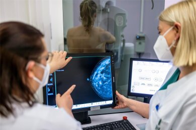 Die vorsorgliche Röntgenuntersuchung der Brust kann Krebstodesfälle verhindern. KI macht die Software noch genauer.