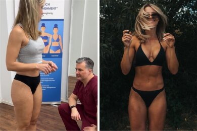 Adrienne Koleszár (39) bei der Untersuchung vor der OP (links), auf Instagram präsentiert sie sich gerne körperbetont.