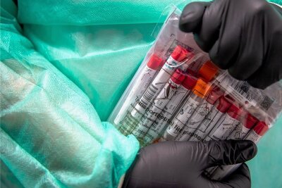 In einigen Urlaubsländern wird zur Einreise noch immer ein negativer PCR-Test vor der Einreise verlangt.
