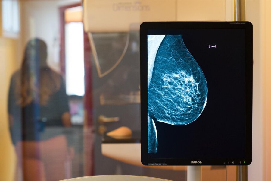 Bei Brustkrebs wird Chemotherapie immer seltener - Wichtige Vorsorge: So sieht eine gesunde Brust in der Röntgenaufnahme aus.