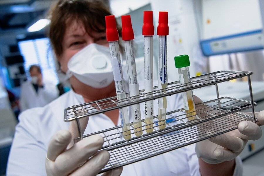 Eine Mitarbeiterin am Institut für Virologie der Technischen Universität München bereitet im Labor Coronaproben zur Analyse vor. 