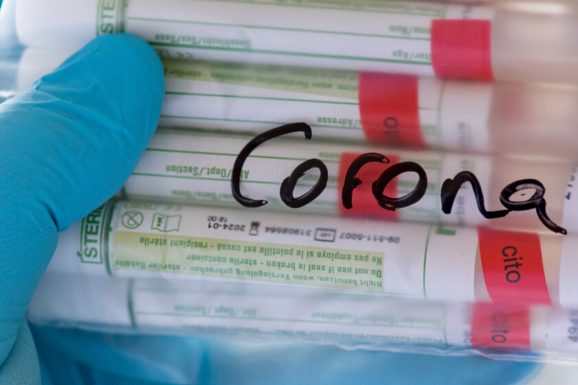 Bislang 148 Menschen in Sachsen nach Coronavirus-Infektion gestorben - 