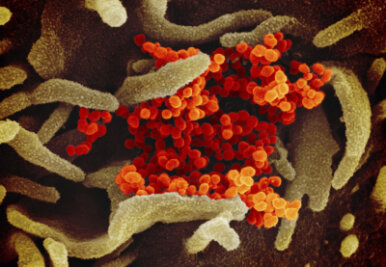 Corona: Die Lage im Vogtland am Donnerstag - Eine undatierte elektronenmikroskopische Aufnahme des «U.S. National Institute of Health» zeigt das neuartige Coronavirus (SARS-CoV-2) (orange), das aus der Oberfläche von im Labor kultivierten Zellen (grau) austritt. 