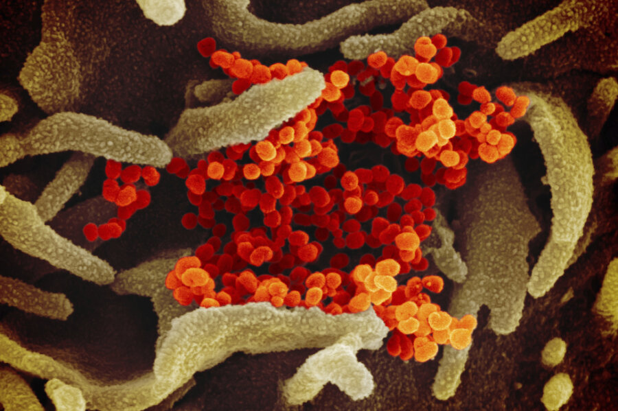 Corona: Die Lage im Vogtland am Donnerstag - Eine undatierte elektronenmikroskopische Aufnahme des «U.S. National Institute of Health» zeigt das neuartige Coronavirus (SARS-CoV-2) (orange), das aus der Oberfläche von im Labor kultivierten Zellen (grau) austritt. 