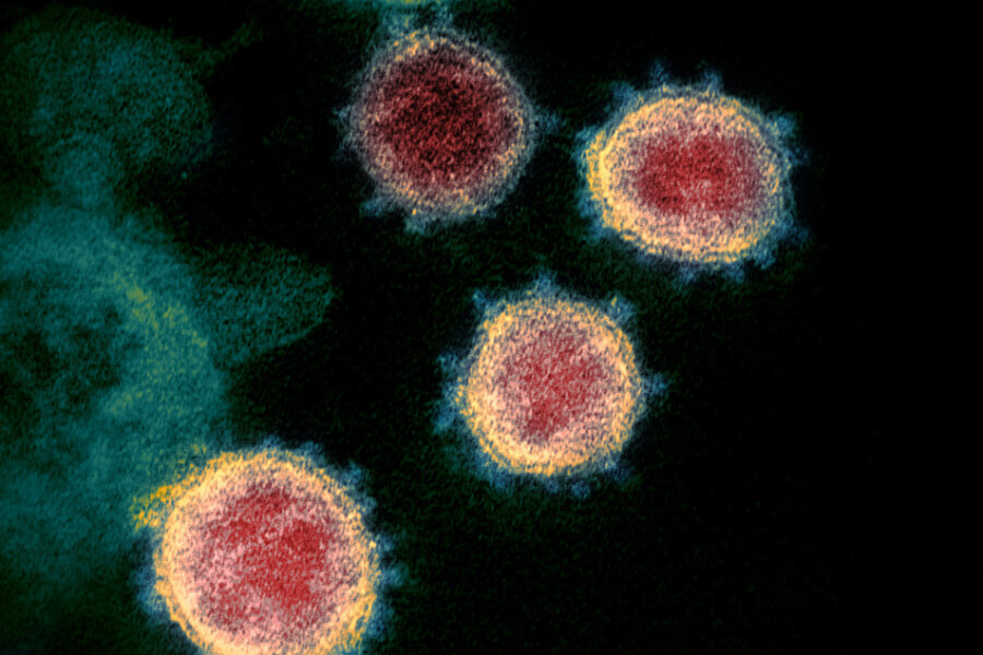 Corona: Die Lage im Vogtland am Freitag - Undatierte elektronenmikroskopische Aufnahme, die von den U.S. National Institutes of Health im Februar 2020 zur Verfügung gestellt wurde, zeigt das Virus, das Covid-19 verursacht.