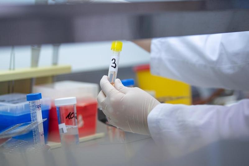            Eine Ärztin zeigt in einem Labor einen Test für das Coronavirus.