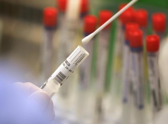 Corona in Sachsen: Inzidenzwert klettert auf 146 - elf neue Todesfälle - Ein Wattestäbchen mit einem Abstrich wird im Labor für einen Corona-Test verarbeitet.