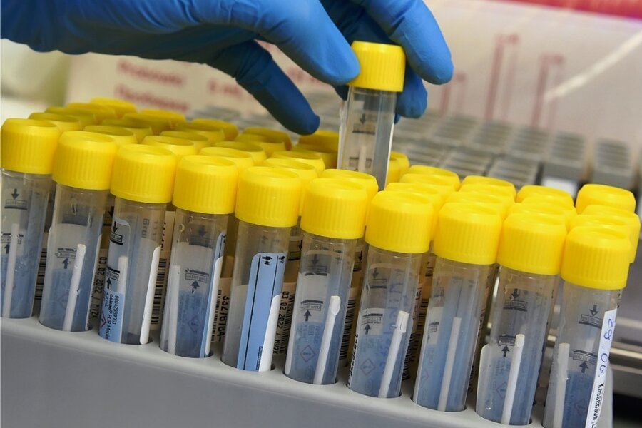 Corona-Infektionen: Landratsamt im Vogtlandkreis ruft nicht mehr an - Nach dem positiven PCR-Test werden die Betroffenen im Vogtland in der Regel per SMS direkt vom Labor kontaktiert. 