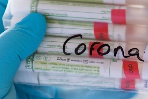 Coronavirus - die aktuelle Entwicklung - Proben für Corona-Tests werden für die weitere Untersuchung vorbereitet.