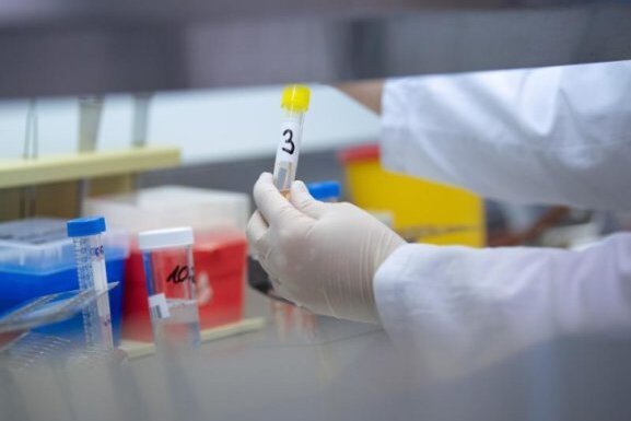 Coronavirus: Die Lage am Osterwochenende in Chemnitz - Eine Ärztin zeigt in einem Labor einen Test für das Coronavirus. 