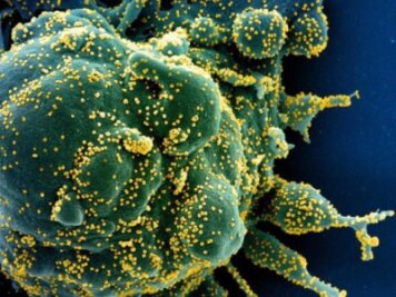 Coronavirus: Die Lage in Chemnitz am Montag - Eine Zelle (grün) mit dem Coronavirus (SARS-CoV-2, gelb) infiziert. 