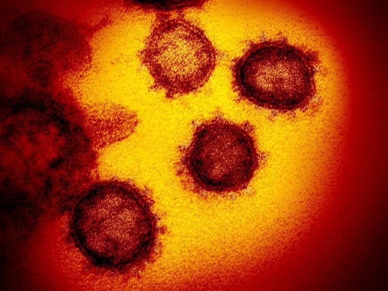 Coronavirus: Drei weitere Todesfälle in Sachsen - Eine undatierte elektronenmikroskopische Aufnahme des Coronavirus (SARS-CoV-2).