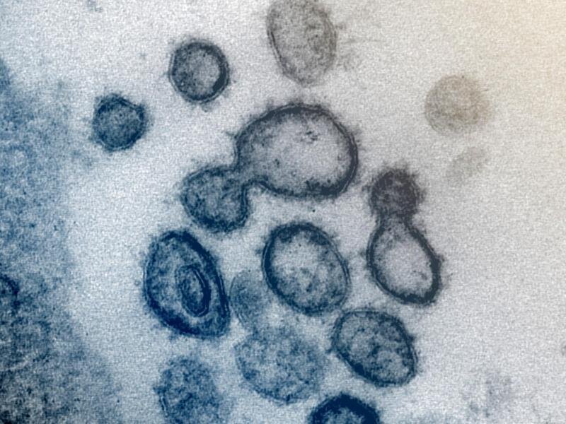 Coronavirus: Mehr als 4000 nachgewiesene Infektionen und 87 Tote in Sachsen -             Elektronenmikroskopische Aufnahme zeigt das neuartige Coronavirus SARS-CoV-2.