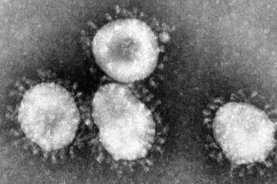 Coronavirus: Zahl der Infektionen im Landkreis Zwickau leicht angestiegen - Am Mittwoch vermeldete das Landratsamt insgesamt 752 nachgewiesene Infektionen im Landkreis Zwickau.