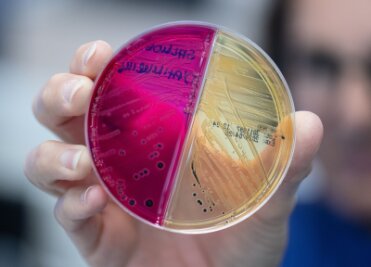 Detektivarbeit am Darm-Mikrobiom: Was Stuhlproben verraten - Auf unterschiedlich eingefärbten Nährböden wachsen Keime heran, die zur genauen Analyse eingesandt wurden.