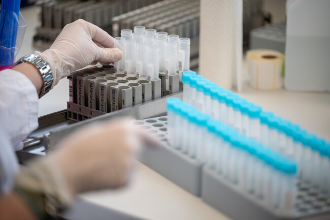 Eine Labormitarbeiterin bereitet im Bioscientia MVZ Labor Mittelhessen Teströhrchen für einen PCR-Test vor. Innerhalb eines Tages ist die Zahl der sicher nachgewiesenen und wahrscheinlichen Omikron-Fälle in Deutschland laut Robert Koch-Institut (RKI) um ein Viertel gestiegen.