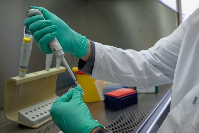 Ein PCR-Test für die Analyse auf Mutationen des Coronavirus wird in einem Labor vorbereitet.