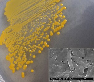 Freiberger Forscher entdecken Bakterium - 