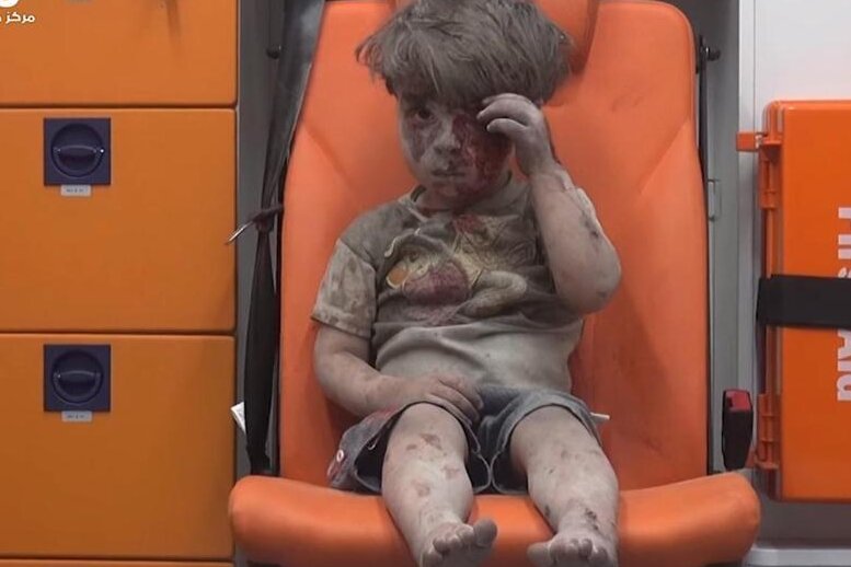 Herzzerreißendes Video zeigt kleinen Jungen als Bombenopfer in Aleppo
