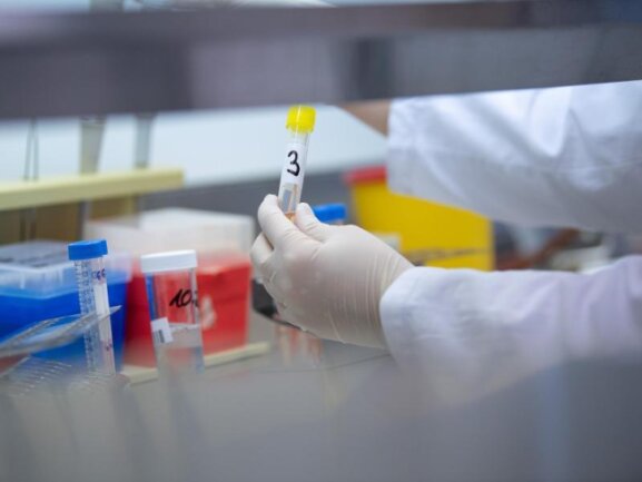 Eine Ärztin zeigt in einem Labor einen Test für das Coronavirus.