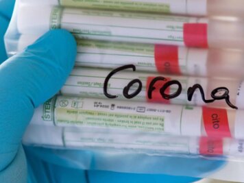            Proben für Corona-Tests werden für die weitere Untersuchung vorbereitet.
