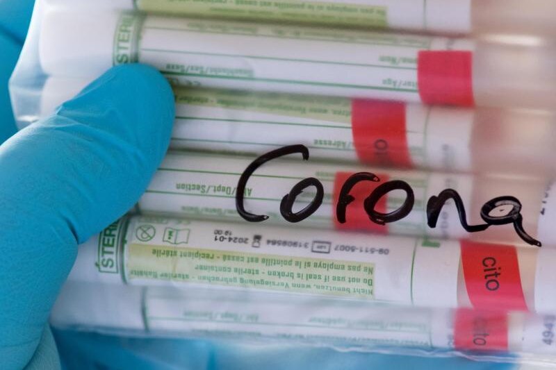            Proben für Corona-Tests werden für die weitere Untersuchung vorbereitet.