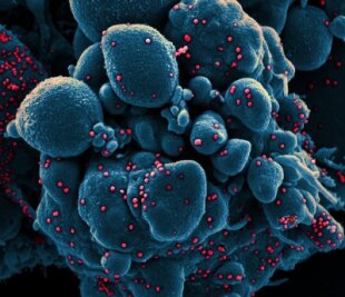 Jetzt 200 Tote nach Coronainfektion in Sachsen - Ein vom "National Institute of Allergy and Infectious Diseases" aufgenommenes Bild zeigt einer Zelle (blau), die mit dem Coronavirus (rot) infiziert ist.