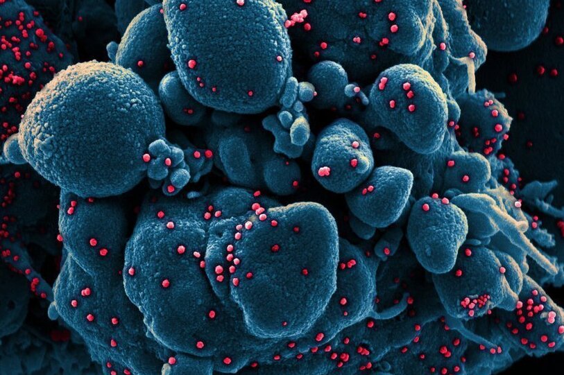 Jetzt 200 Tote nach Coronainfektion in Sachsen - Ein vom "National Institute of Allergy and Infectious Diseases" aufgenommenes Bild zeigt einer Zelle (blau), die mit dem Coronavirus (rot) infiziert ist.
