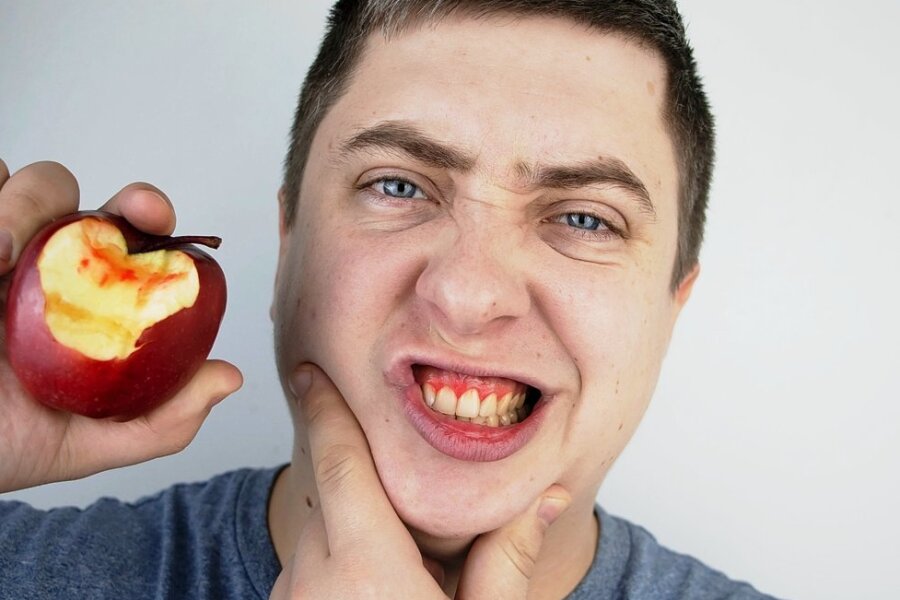 Alarmzeichen rot: Das Zahnfleisch blutet beim Biss in den Apfel. 