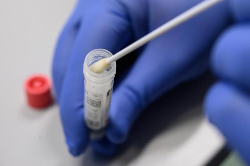            Ein medizinischer Mitarbeiter legt einen Tupfer mit einem Abstrich für einen Corona-Test in ein Teströhrchen.