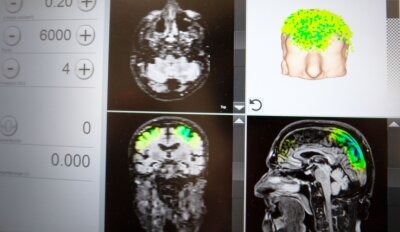 Neue Demenzbehandlung in Mittweida: Stoßwellen wecken Nervenzellen auf - 