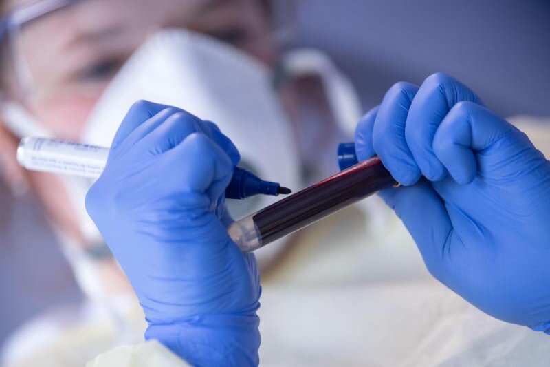            Ein Mitarbeiterin des Robert Koch-Instituts (RKI) beschriftet eine Blutprobe für einen Antikörpertest.