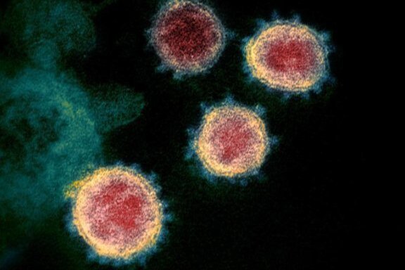 Newsblog Coronavirus - die aktuelle Entwicklung - Diese elektronenmikroskopische Aufnahme des U.S. National Institutes of Health zeigt das neuartige Coronavirus (SARS-CoV-2), das Covid-19 verursacht.