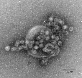 Norovirus am Gardasee - Hunderte Menschen im Krankenhaus - Das hochansteckende Norovirus verursacht einen plötzlich auftretenden, heftigen Brechdurchfall.