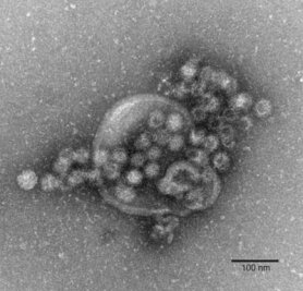 Norovirus geht in Kitas im Vogtland um - 