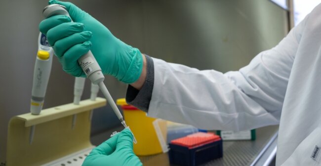 Ein Forscher zeigt, wie ein PCR-Test für die Analyse auf Mutationen des Coronavirus vorbereitet wird. 