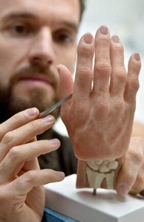 Sachsen entwickelt sich zu einem Zentrum der Medizintechnik - Silikontechniker Alex Stamos arbeitet an einer Handprothese. Die Silikonhand mit 3D-gedrucktem Skelett ist besonders weich. 