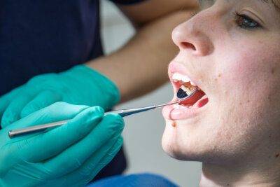 Sachsens Zahnärzte kritisieren geplante Einsparung bei Parodontitis-Therapie - 