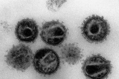 Warum gibt es nach 40 Jahren noch keine Impfung gegen HIV? - Elektronenmikroskopaufnahme von HI-Viren, den Erregern der Krankheit Aids.