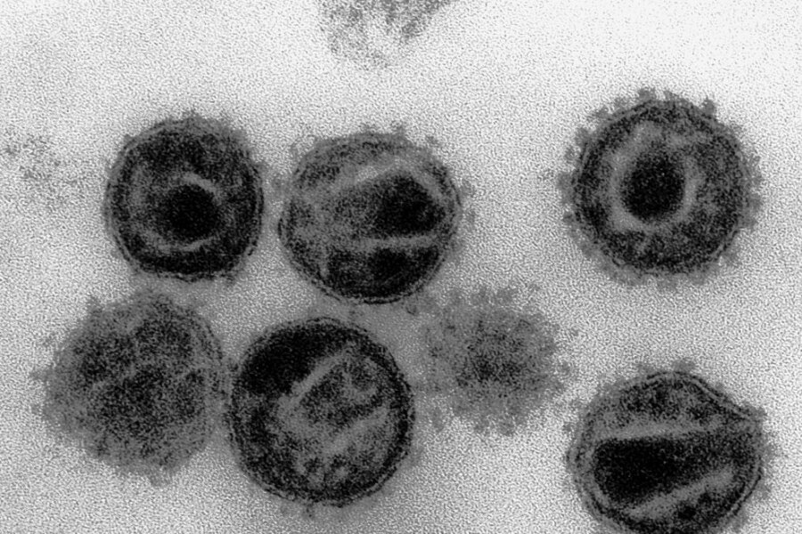 Elektronenmikroskopaufnahme von HI-Viren, den Erregern der Krankheit Aids.