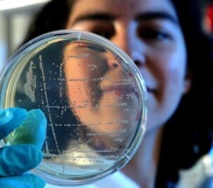 Was bringt der Test auf Bakterien bei Schwangeren? - Positiver Bakterientest.
