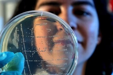 Was bringt der Test auf Bakterien bei Schwangeren? - Positiver Bakterientest.