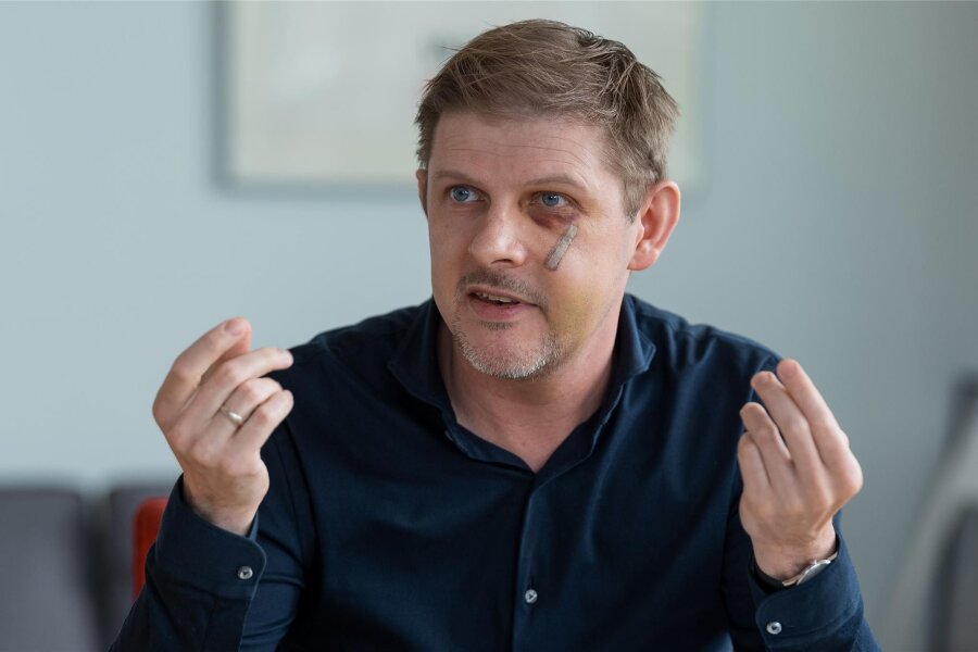 Wie der SPD-Europaabgeordnete Matthias Ecke den Angriff auf ihn im Wahlkampf in Dresden erlebte - Der Europaabgeordnete Matthias Ecke (SPD).