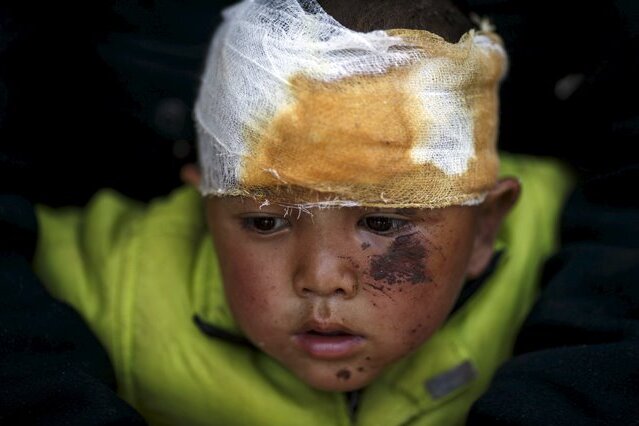 Zwischen Hoffen und Helfen - Gezeichnet von der Katastrophe: ein vierjähriger Junge im Krankenhaus von Dhading, westlich von Kathmandu.